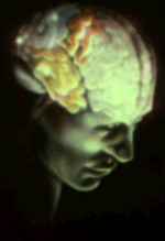 Brain